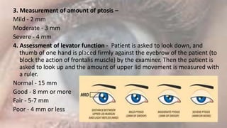 Levator Function Testing Diseases of eyelid.pptx