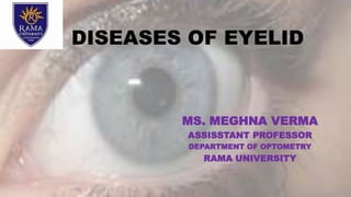 DISEASES OF EYELID
MS. MEGHNA VERMA
ASSISSTANT PROFESSOR
DEPARTMENT OF OPTOMETRY
RAMA UNIVERSITY
 