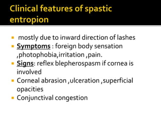 Eye lid disorders | PPTX