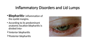 eyelid disorders and tumors - DIAGNOSIS AND MANAGEMENT | PPTX
