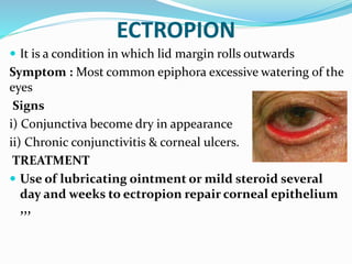 ECTROPION
 It is a condition in which lid margin rolls outwards
Symptom : Most common epiphora excessive watering of the
eyes
Signs
i) Conjunctiva become dry in appearance
ii) Chronic conjunctivitis & corneal ulcers.
TREATMENT
 Use of lubricating ointment or mild steroid several
day and weeks to ectropion repair corneal epithelium
,,,
 