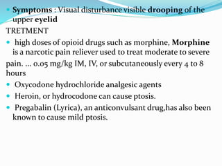  Symptoms : Visual disturbance visible drooping of the
upper eyelid
TRETMENT
 high doses of opioid drugs such as morphine, Morphine
is a narcotic pain reliever used to treat moderate to severe
pain. ... 0.05 mg/kg IM, IV, or subcutaneously every 4 to 8
hours
 Oxycodone hydrochloride analgesic agents
 Heroin, or hydrocodone can cause ptosis.
 Pregabalin (Lyrica), an anticonvulsant drug,has also been
known to cause mild ptosis.
 
