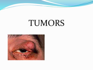 TUMORS
 