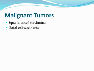 Malignant Tumors
 Squamous cell carcinoma
 Basal cell carcinoma
 