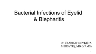 Bacterial Infections of Eyelid
& Blepharitis
Dr. PRABHAT DEVKOTA
MBBS (TU), MD (NAMS)
1
 