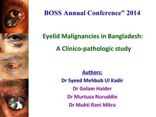 Eyelid Malignancies in Bangladesh:
A Clinico-pathologic study
Authors:
Dr Syeed Mehbub Ul Kadir
Dr Golam Haider
Dr Murtuza Nuruddin
Dr Mukti Rani Mitra
BOSS Annual Conference” 2014
 