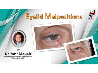 By
Assistant Professor of Ophthalmology
Sohag University
 