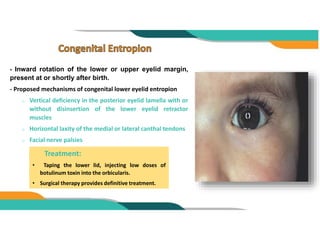 Eyelid malposition | PPTX