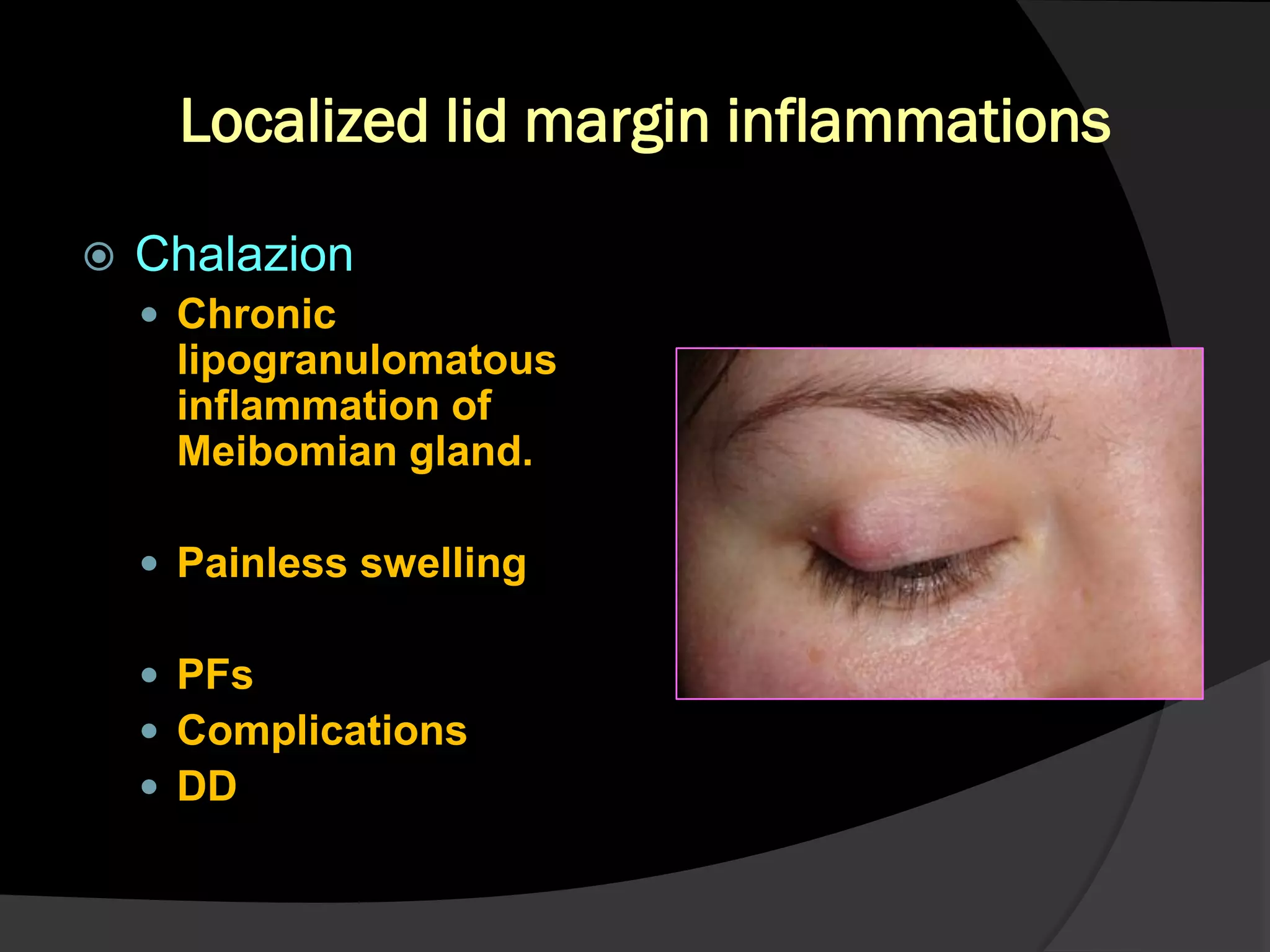 Eyelid pathology 1 | PDF