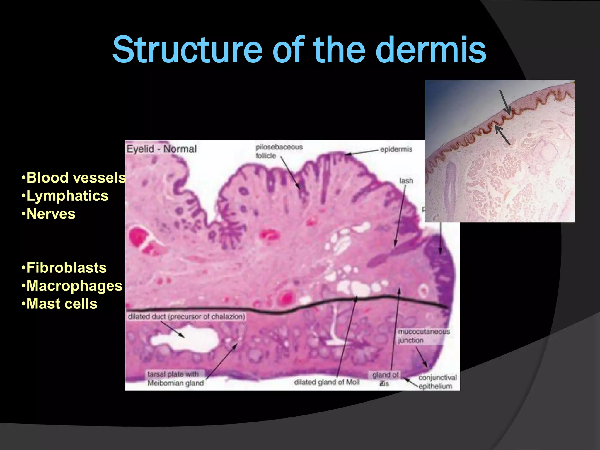 Dermal Eyelets Eyelid pathology 1 | PDF