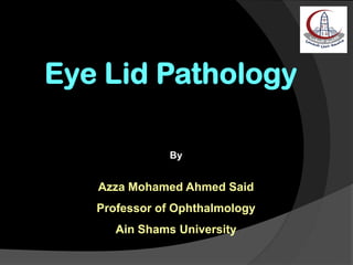 By
Azza Mohamed Ahmed Said
Professor of Ophthalmology
Ain Shams University
 