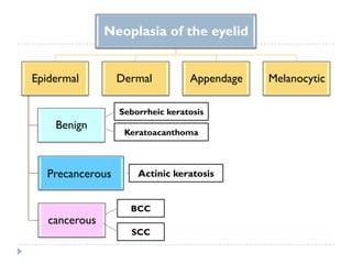 Neoplasia of the eyelid
Epidermal
Benign
Precancerous
cancerous
Dermal Appendage Melanocytic
Seborrheic keratosis
Keratoacanthoma
Actinic keratosis
BCC
SCC
 