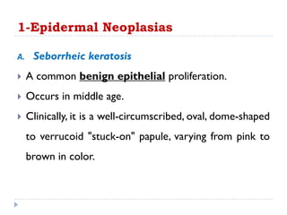 1-Epidermal Neoplasias
A. Seborrheic keratosis
 A common benign epithelial proliferation.
 Occurs in middle age.
 Clinically, it is a well-circumscribed, oval, dome-shaped
to verrucoid "stuck-on" papule, varying from pink to
brown in color.
 