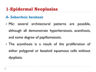 A- Seborrheic keratosis
 Mic: several architectural patterns are possible,
although all demonstrate hyperkeratosis, acanthosis,
and some degree of papillomatosis.
 The acanthosis is a result of the proliferation of
either polygonal or basaloid squamous cells without
dysplasia.
1-Epidermal Neoplasias
 