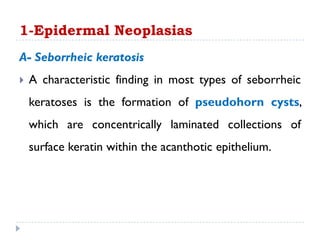 A- Seborrheic keratosis
 A characteristic finding in most types of seborrheic
keratoses is the formation of pseudohorn cysts,
which are concentrically laminated collections of
surface keratin within the acanthotic epithelium.
1-Epidermal Neoplasias
 