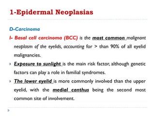 D-Carcinoma
I- Basal cell carcinoma (BCC) is the most common malignant
neoplasm of the eyelids, accounting for > than 90% of all eyelid
malignancies.
 Exposure to sunlight is the main risk factor, although genetic
factors can play a role in familial syndromes.
 The lower eyelid is more commonly involved than the upper
eyelid, with the medial canthus being the second most
common site of involvement.
1-Epidermal Neoplasias
 