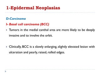 D-Carcinoma
I- Basal cell carcinoma (BCC)
 Tumors in the medial canthal area are more likely to be deeply
invasive and to involve the orbit.
 Clinically, BCC is a slowly enlarging, slightly elevated lesion with
ulceration and pearly, raised, rolled edges.
1-Epidermal Neoplasias
 