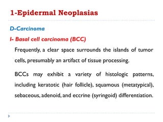 D-Carcinoma
I- Basal cell carcinoma (BCC)
Frequently, a clear space surrounds the islands of tumor
cells, presumably an artifact of tissue processing.
BCCs may exhibit a variety of histologic patterns,
including keratotic (hair follicle), squamous (metatypical),
sebaceous, adenoid, and eccrine (syringoid) differentiation.
1-Epidermal Neoplasias
 