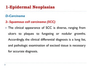 D-Carcinoma
2- Squamous cell carcinoma (SCC)
 The clinical appearance of SCC is diverse, ranging from
ulcers to plaques to fungating or nodular growths.
Accordingly, the clinical differential diagnosis is a long list,
and pathologic examination of excised tissue is necessary
for accurate diagnosis.
1-Epidermal Neoplasias
 