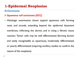 D-Carcinoma
I- Squamous cell carcinoma (SCC)
 Histologic examination shows atypical squamous cells forming
nests and strands, extending beyond the epidermal basement
membrane, infiltrating the dermis, and in citing a fibrotic tissue
reaction. Tumor cells may be well differentiated (forming keratin
and easily recognizable as squamous), moderately differentiated,
or poorly differentiated (requiring ancillary studies to confirm the
nature of the neoplasm).
1-Epidermal Neoplasias
 