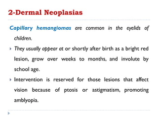 2-Dermal Neoplasias
Capillary hemangiomas are common in the eyelids of
children.
 They usually appear at or shortly after birth as a bright red
lesion, grow over weeks to months, and involute by
school age.
 Intervention is reserved for those lesions that affect
vision because of ptosis or astigmatism, promoting
amblyopia.
 