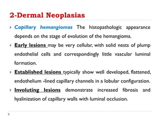  Capillary hemangiomas The histopathologic appearance
depends on the stage of evolution of the hemangioma.
 Early lesions may be very cellular, with solid nests of plump
endothelial cells and correspondingly little vascular luminal
formation.
 Established lesions typically show well developed, flattened,
endothelium -lined capillary channels in a lobular configuration.
 Involuting lesions demonstrate increased fibrosis and
hyalinization of capillary walls with luminal occlusion.
2-Dermal Neoplasias
 