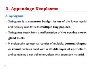 3- Appendage Neoplasms
A- Syringoma
 Syringoma is a common benign lesion of the lower eyelid
and typically manifests as multiple tiny papules.
 Syringomas result from a malformation of the eccrine sweat
gland ducts.
 Histologically, syringomas consist of multiple, comma-shaped
or round ductules lined with a double layer of epithelium
and containing a central lumen, often with secretory material.
 