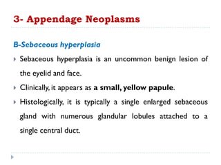 B-Sebaceous hyperplasia
 Sebaceous hyperplasia is an uncommon benign lesion of
the eyelid and face.
 Clinically, it appears as a small, yellow papule.
 Histologically, it is typically a single enlarged sebaceous
gland with numerous glandular lobules attached to a
single central duct.
3- Appendage Neoplasms
 