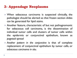  When sebaceous carcinoma is suspected clinically, the
pathologist should be alerted so that frozen section slides
can be generated for lipid stains.
 Another feature, characteristic of but not pathognomonic
for sebaceous cell carcinoma, is the dissemination of
individual tumor cells and clusters of tumor cells within
the epidermis or conjunctival epithelium, known as
pagetoid spread
 Another pattern in the conjunctiva is that of complete
replacement of conjunctival epithelium by tumor cells, or
sebaceous carcinoma in situ.
3- Appendage Neoplasms
 