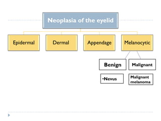 Neoplasia of the eyelid
Epidermal Dermal Appendage Melanocytic
Benign Malignant
•Nevus Malignant
melanoma
 