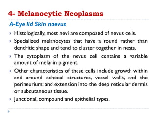  Histologically, most nevi are composed of nevus cells.
 Specialized melanocytes that have a round rather than
dendritic shape and tend to cluster together in nests.
 The cytoplasm of the nevus cell contains a variable
amount of melanin pigment.
 Other characteristics of these cells include growth within
and around adnexal structures, vessel walls, and the
perineurium; and extension into the deep reticular dermis
or subcutaneous tissue.
 Junctional, compound and epithelial types.
4- Melanocytic Neoplasms
A-Eye lid Skin naevus
 