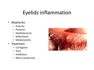 Eyelids inflammation
• Blepharitis
   –   Anterior
   –   Posterior
   –   Staphylococcal
   –   Seborrhoeic
   –   Meibomianitis
• Treatment
   –   Lid hygiene
   –   Tears
   –   Antibiotics
   –   Warm compresses
 