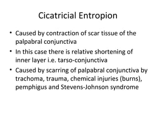 Cicatricial Entropion
• Caused by contraction of scar tissue of the
  palpabral conjunctiva
• In this case there is relative shortening of
  inner layer i.e. tarso-conjunctiva
• Caused by scarring of palpabral conjunctiva by
  trachoma, trauma, chemical injuries (burns),
  pemphigus and Stevens-Johnson syndrome
 