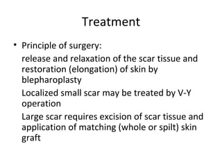 Treatment
• Principle of surgery:
  release and relaxation of the scar tissue and
  restoration (elongation) of skin by
  blepharoplasty
  Localized small scar may be treated by V-Y
  operation
  Large scar requires excision of scar tissue and
  application of matching (whole or spilt) skin
  graft
 