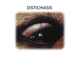DISTICHIASIS
 