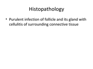 Histopathology
• Purulent infection of follicle and its gland with
  cellulitis of surrounding connective tissue
 