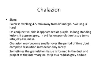 Chalazion
• Signs:
  Painless swelling 4-5 mm away from lid margin. Swelling is
  hard
  On conjunctival side it appears red or purple. In long standing
  lesions it appears grey. In old lesion granulation tissue turns
  into jelly-like mass.
  Chalazion may become smaller over the period of time , but
  complete resolution may occur only rarely
  Sometimes the granulation tissue is formed in the duct and
  project at the intermarginal strip as a reddish grey nodule
 