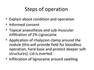 Steps of operation
• Explain about condition and operation
• Informed consent
• Topical anaesthesia and sub-muscular
  infiltration of 2% Lignocaine
• Application of chalazion clamp around the
  nodule (this will provide field for bloodless
  operation, hard base and protect deeper soft
  structures). Lid is everted
• Infiltration of lignocaine around swelling
 