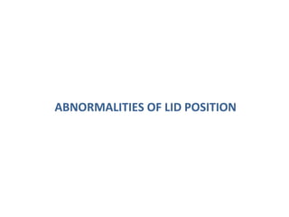 ABNORMALITIES OF LID POSITION
 