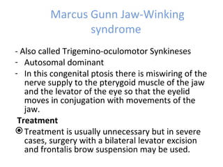 Marcus Gunn Jaw-Winking
                syndrome
- Also called Trigemino-oculomotor Synkineses
- Autosomal dominant
- In this congenital ptosis there is miswiring of the
   nerve supply to the pterygoid muscle of the jaw
   and the levator of the eye so that the eyelid
   moves in conjugation with movements of the
   jaw.
 Treatment
 Treatment is usually unnecessary but in severe
   cases, surgery with a bilateral levator excision
   and frontalis brow suspension may be used.
 