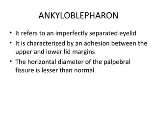 ANKYLOBLEPHARON
• It refers to an imperfectly separated eyelid
• It is characterized by an adhesion between the
  upper and lower lid margins
• The horizontal diameter of the palpebral
  fissure is lesser than normal
 