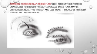 • TEMPORAL FOREHEAD FLAP (FRICKE FLAP) WHEN ADEQUATE LID TISSUE IS
UNAVAILABLE FOR DONOR TISSUE, TEMPORALLY BASED FLAPS MAY BE
USEFULTISSUE QUALITY IS THICKER AND LESS IDEAL; IT SHOULD BE RESERVED
FOR SPECIAL CIRCUMSTANCES.
 