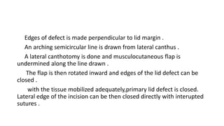 Edges of defect is made perpendicular to lid margin .
An arching semicircular line is drawn from lateral canthus .
A lateral canthotomy is done and musculocutaneous flap is
undermined along the line drawn .
The flap is then rotated inward and edges of the lid defect can be
closed .
with the tissue mobilized adequately,primary lid defect is closed.
Lateral edge of the incision can be then closed directly with interupted
sutures .
 