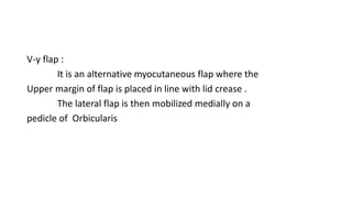 V-y flap :
It is an alternative myocutaneous flap where the
Upper margin of flap is placed in line with lid crease .
The lateral flap is then mobilized medially on a
pedicle of Orbicularis
 