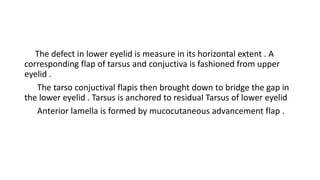 The defect in lower eyelid is measure in its horizontal extent . A
corresponding flap of tarsus and conjuctiva is fashioned from upper
eyelid .
The tarso conjuctival flapis then brought down to bridge the gap in
the lower eyelid . Tarsus is anchored to residual Tarsus of lower eyelid
Anterior lamella is formed by mucocutaneous advancement flap .
 