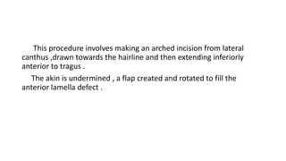 This procedure involves making an arched incision from lateral
canthus ,drawn towards the hairline and then extending inferiorly
anterior to tragus .
The akin is undermined , a flap created and rotated to fill the
anterior lamella defect .
 