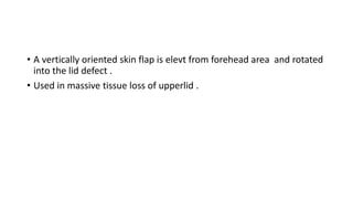 • A vertically oriented skin flap is elevt from forehead area and rotated
into the lid defect .
• Used in massive tissue loss of upperlid .
 