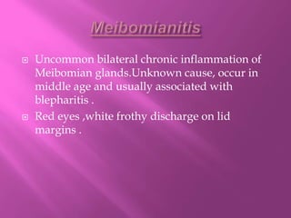  Uncommon bilateral chronic inflammation of
Meibomian glands.Unknown cause, occur in
middle age and usually associated with
blepharitis .
 Red eyes ,white frothy discharge on lid
margins .
 