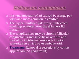  It is viral infection of lid caused by a large pox
virus and more common in children.
 The typical multiple,pale,waxy,umblicated
swellings scattered over the skin near lid
margin.
 The complications may be chronic follicular
conjunctivitis and superficial keratitis and
treated by incision,expression & interior
cauterisation by iodine or carbolic acid.
 Treatment:-Removal of secretions by cotton
application (no good result)
 