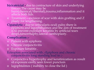 b)cicatricial –due to contracture of skin and underlying
tissues.The cause may be
burn(chemical/thermal),trauma,inflammation and it
affects both lids.
 Treatment—excision of scar with skin grafting and Z
plasty for lengthening.
C)paralytic –due to orbicularis oculi palsy.there is
epiphora and lagophthalmos and the aim of treatment
is to prevent exposure keratitis by artificial tears
drops,tarsorrhaphy,lateral canthoplasty.
Complication :-
 Patient with epiphora
 Chronic conjunctivitis
 Exposure keratitis .
Ectropion associated with ;-Epiphora and chronic
conjunctivitis long standing lead to ;-
 Conjunctiva hypertrophy and keratinization as result
of exposure easily seen lower punctum
 lagophtalmos ( inability to close the lid )
 